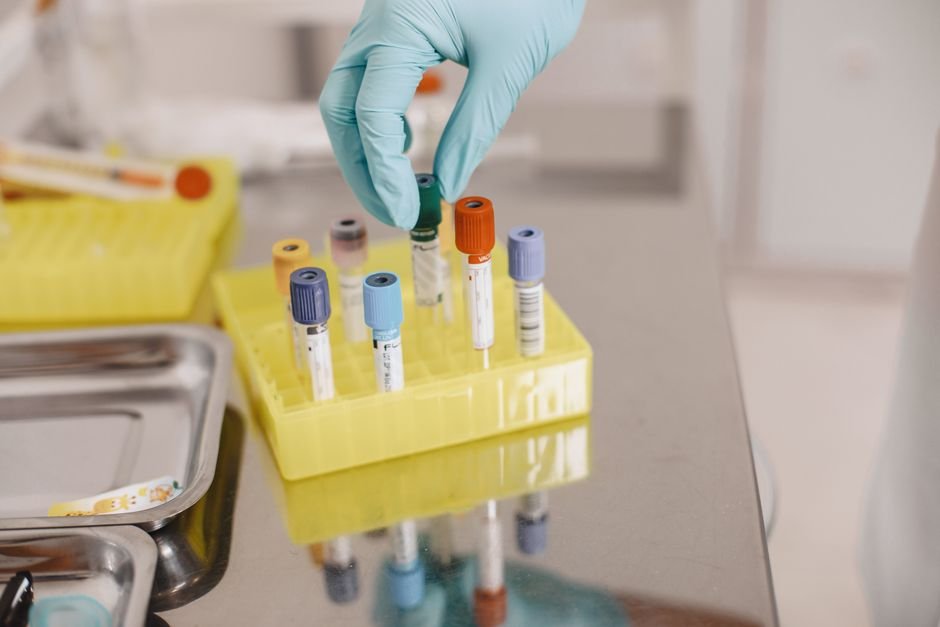 Exames laboratoriais para atletas: o que monitorar para melhor performance