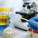 Exame de urina detecta infecção?
